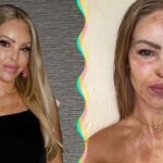 “I’ve Reached the End of the Road,” Katie Piper Shares a Bright Update 16 Years After Acid Attack