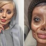 The girl underwent 50 plastic surgeries to look like Angelina Jolie — this is how she looked before.