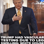Trump diagnosed with chronic venous insufficiency after vascular testing: White House…