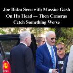 Biden Spotted With Huge Post-Op Scar As Health Questions Loom