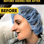 Woman Spends Over A Decade Saving For A Nose Job—But Better Sit Down Before Seeing Her After